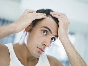 Hair-Loss-Treatment-for-Men