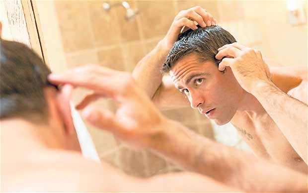 Best-Hair-Loss-Treatment-Tips-for-Men