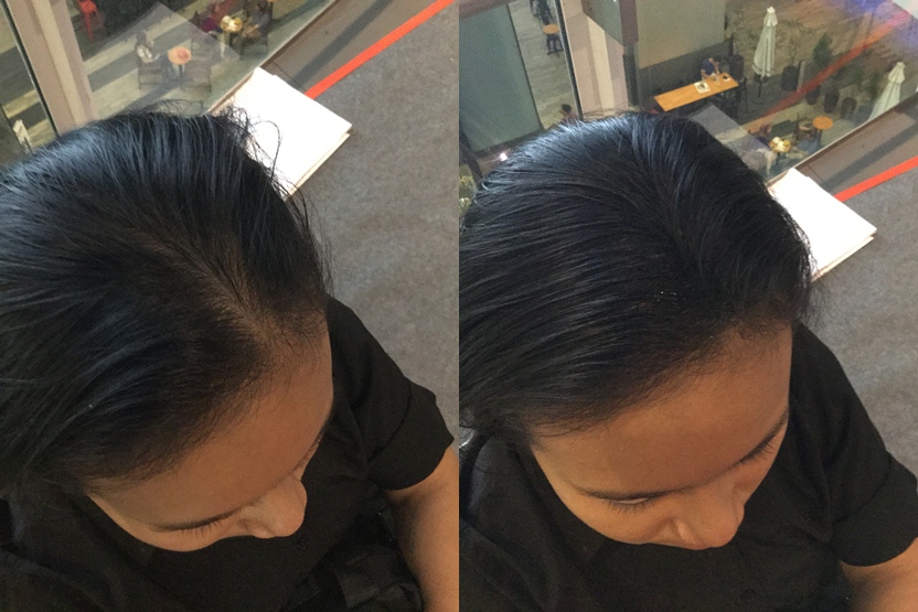 siti aisha trying out our toppik hairloss treatment in malaysia