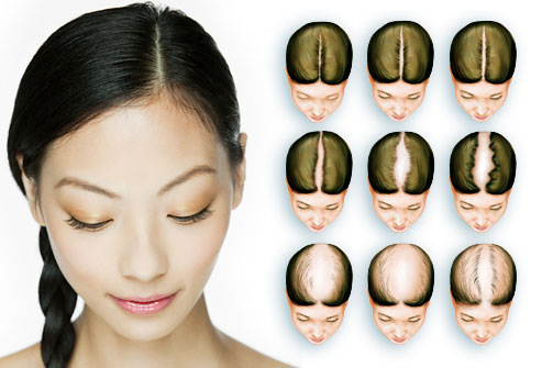 Top 5 Causes of Hair Loss and Hair Thinning In Women - Toppik Malaysia