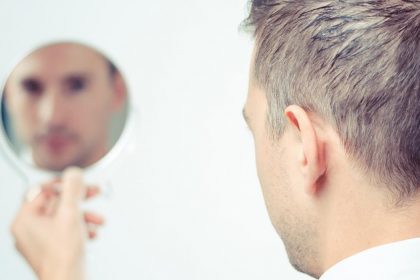 hair loss