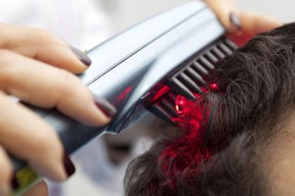 laser hair loss treatment