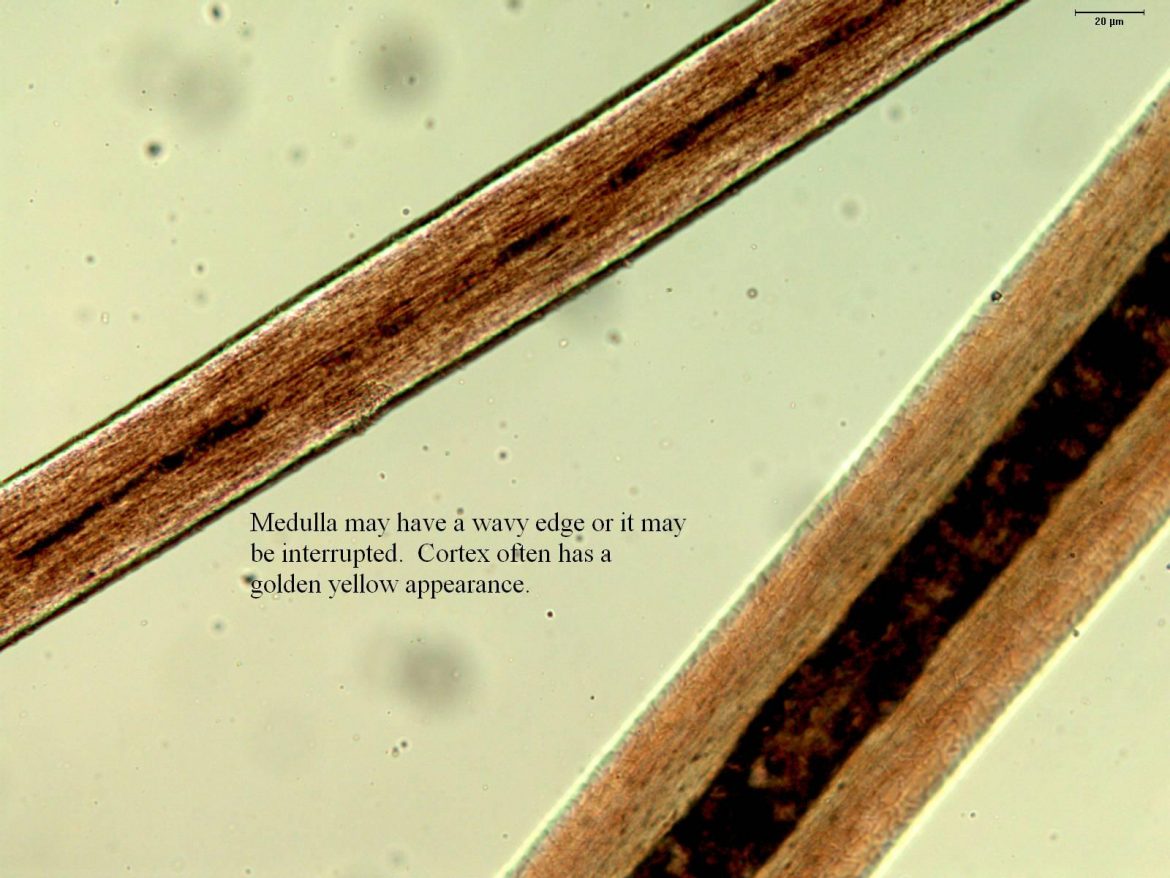 Hair Under The Microscope ( Toppik Malaysia ) Toppik Malaysia