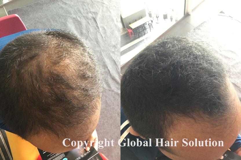 ahmad using toppik hair building fiber in malaysia
