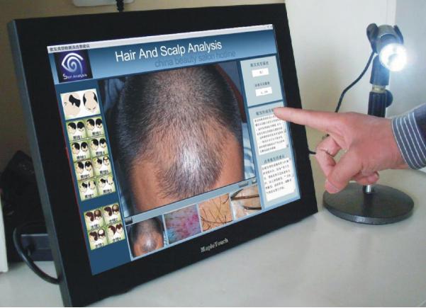 hair loss treatment malaysia