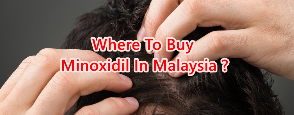 Buy Minoxidil For Hair Loss in (Pharmacies & Clinics) - Toppik Malaysia