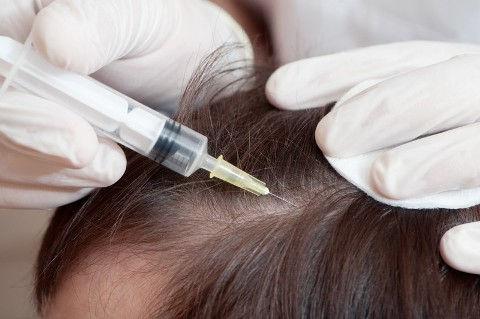 Mesoterapi (Mesotherapy)