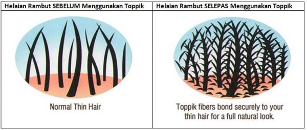 cara merawat rambut gugur