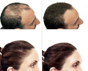produk melebatkan rambut