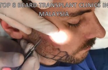 beard