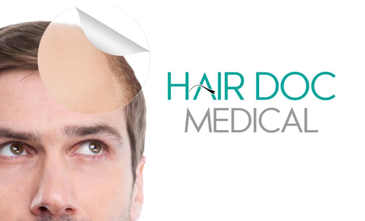 Top 9 Hair Loss Treatments in Penang Toppik Malaysia