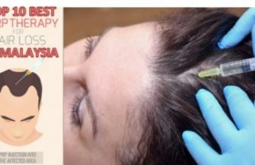 prp hair treatment malaysia